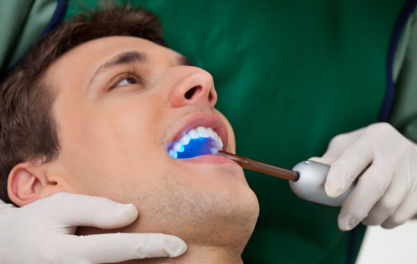Teeth Whitening in Cerritos California